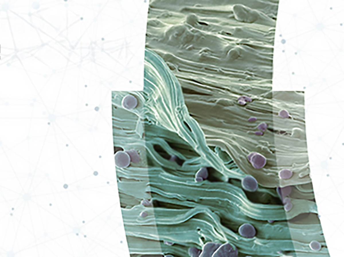 Grains of the original starch (purple) are still visible in this electron micrograph (3000× magnification) of a biodegradable PLA carrier bag